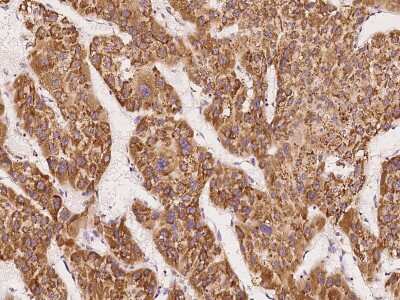 Immunohistochemistry-Paraffin: DDOST Antibody [NBP2-99995]