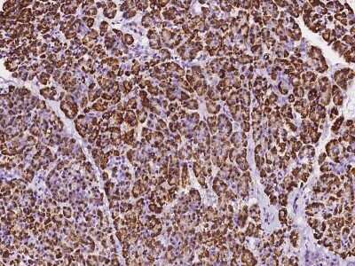 Immunohistochemistry-Paraffin: DDOST Antibody [NBP2-99995]