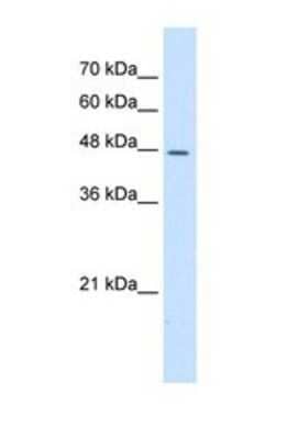 Western Blot: DDOST Antibody [NBP1-69562]