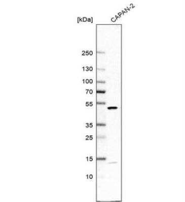 Western Blot: DDOST Antibody [NBP2-38560]