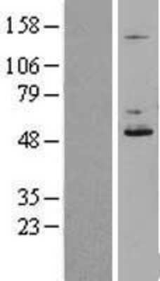 Western Blot: DDOST Overexpression Lysate [NBL1-09776]