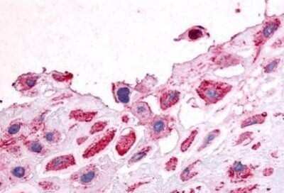 Immunohistochemistry-Paraffin: DDR1 Antibody - BSA Free [NB110-39041]