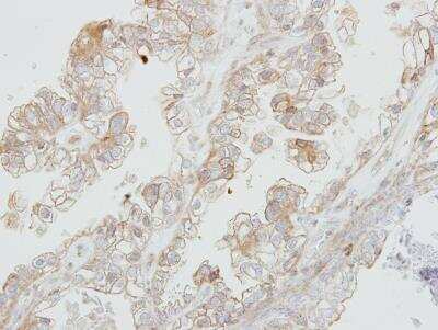 Immunohistochemistry-Paraffin: DDR1 Antibody [NBP1-33134]