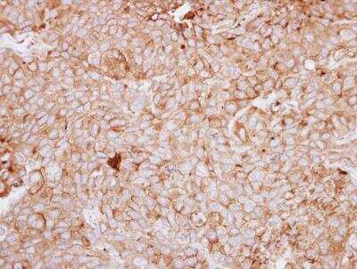 Immunohistochemistry-Paraffin: DDR1 Antibody [NBP2-16123]