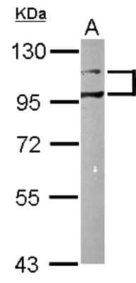 Western Blot: DDR1 Antibody [NBP1-33134]