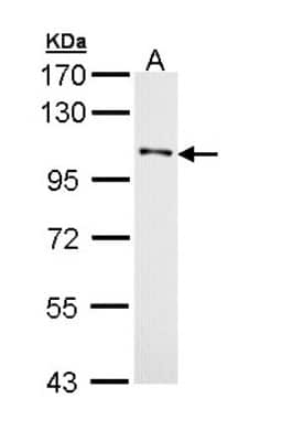 Western Blot: DDR1 Antibody [NBP1-33134]