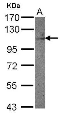 Western Blot: DDR1 Antibody [NBP2-16123]