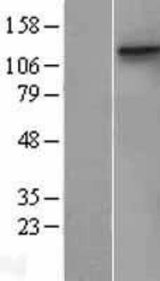 Western Blot: DDR1 Overexpression Lysate [NBL1-09777]