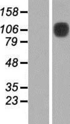 Western Blot: DDR1 Overexpression Lysate [NBP2-09857]