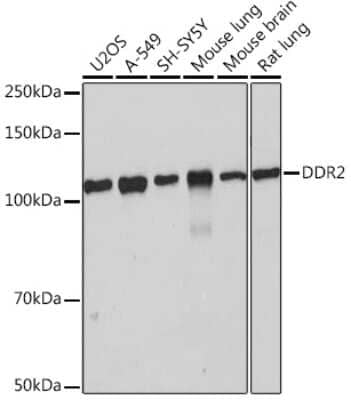 Western Blot: DDR2 Antibody (1M8U7) [NBP3-16371]