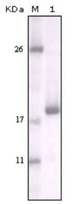 Western Blot: DDR2 Antibody (3B11E4)BSA Free [NBP1-28883]