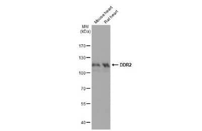 Western Blot: DDR2 Antibody (HL1107) [NBP3-13724]