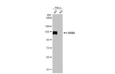 Western Blot: DDR2 Antibody (HL1107) [NBP3-13724]