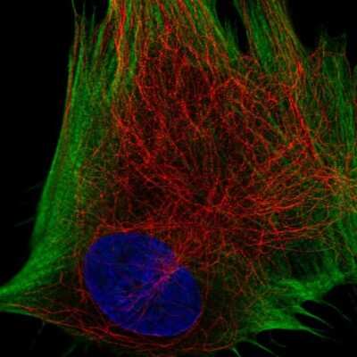 Immunocytochemistry/ Immunofluorescence: DDR2 Antibody [NBP2-56485]