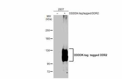 Western Blot: DDR2 Antibody [NBP2-14926]