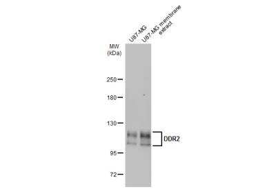 Western Blot: DDR2 Antibody [NBP2-14926]