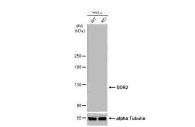 Western Blot: DDR2 Antibody [NBP2-14926]