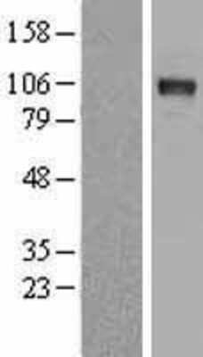 Western Blot: DDR2 Overexpression Lysate [NBP2-08744]