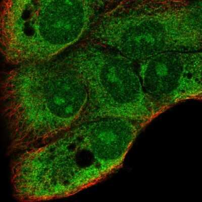 Immunocytochemistry/ Immunofluorescence: DDRGK1 Antibody [NBP2-58287]