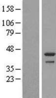 Western Blot: DDRGK1 Overexpression Lysate [NBL1-08360]