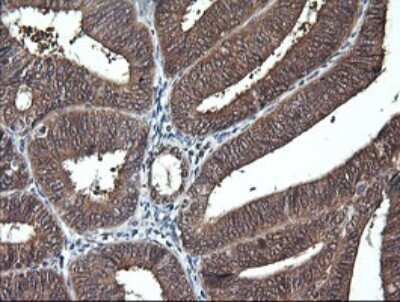 Immunohistochemistry: DDT Antibody (OTI1H3) [NBP2-45677]