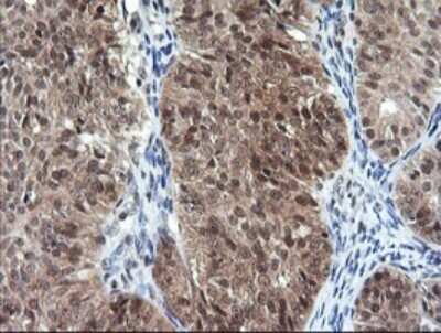 Immunohistochemistry: DDT Antibody (OTI1H3) [NBP2-45677]