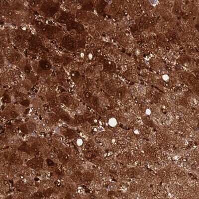 Immunohistochemistry-Paraffin: DDT Antibody [NBP2-13904]