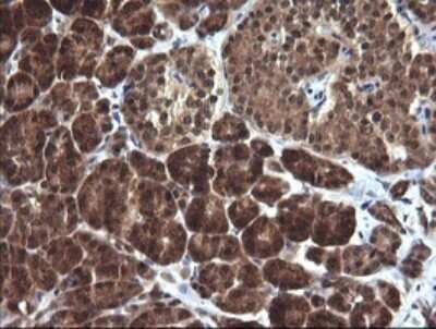 Immunohistochemistry: DDT Antibody (OTI1H3) - Azide and BSA Free [NBP2-70562]