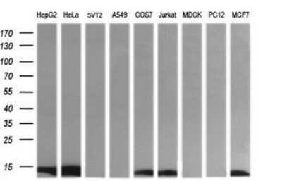 Western Blot: DDT Antibody (OTI1H3)Azide and BSA Free [NBP2-70562]