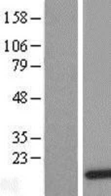 Western Blot: DDT Overexpression Lysate [NBL1-09779]