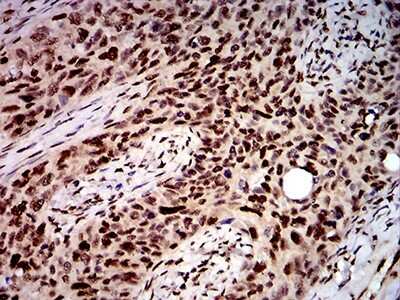 Immunohistochemistry: DDX1 Antibody (3E5B2) - BSA Free [NBP2-61744]