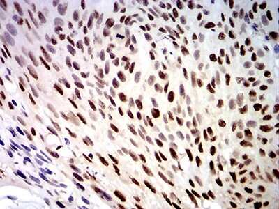 Immunohistochemistry: DDX1 Antibody (3E5B2) - BSA Free [NBP2-61744]