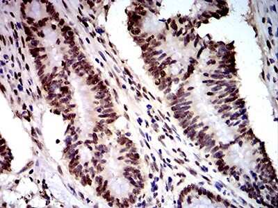 Immunohistochemistry-Paraffin: DDX1 Antibody (3E5E2) - BSA Free [NBP2-61745]