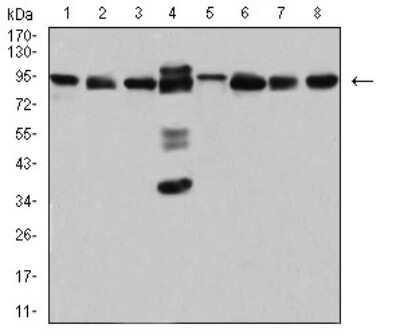 Western Blot: DDX1 Antibody (3E5E2)BSA Free [NBP2-61745]