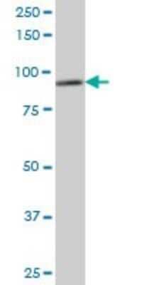 Western Blot: DDX1 Antibody (4F6) [H00001653-M02]