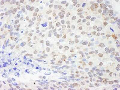 Immunohistochemistry: DDX1 Antibody [NB200-348]