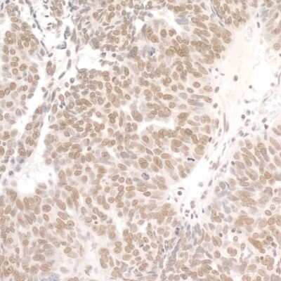 Immunohistochemistry: DDX1 Antibody [NB200-349]