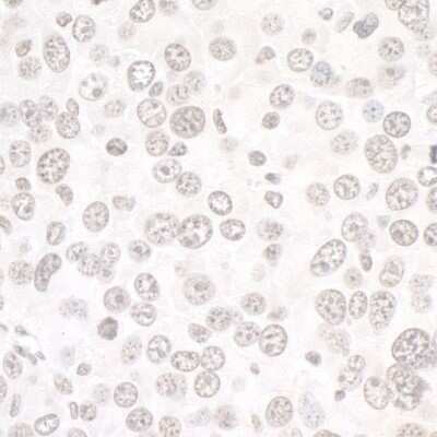 Immunohistochemistry: DDX1 Antibody [NB200-349]