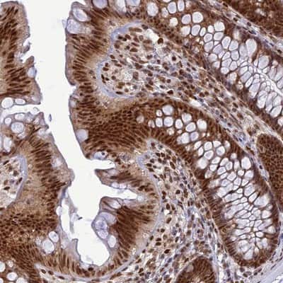 Immunohistochemistry-Paraffin: DDX1 Antibody [NBP1-85293]