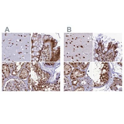 Immunohistochemistry-Paraffin: DDX1 Antibody [NBP1-85293]