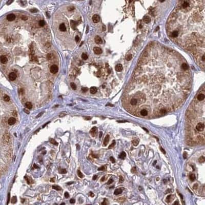 Immunohistochemistry-Paraffin: DDX1 Antibody [NBP1-85293]