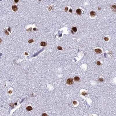 Immunohistochemistry-Paraffin: DDX1 Antibody [NBP1-85293]