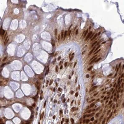 Immunohistochemistry-Paraffin: DDX1 Antibody [NBP1-85293]