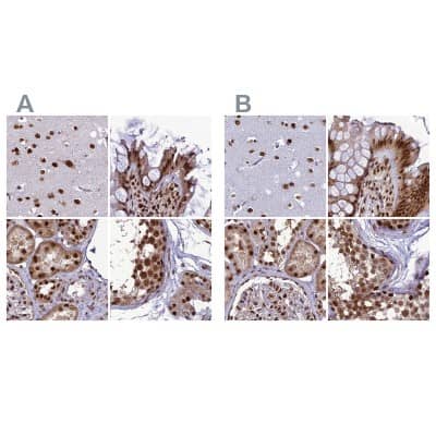 Immunohistochemistry-Paraffin: DDX1 Antibody [NBP1-85294]