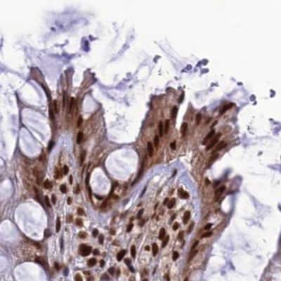 Immunohistochemistry-Paraffin: DDX1 Antibody [NBP1-85294]