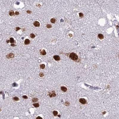 Immunohistochemistry-Paraffin: DDX1 Antibody [NBP1-85294]