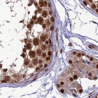 Immunohistochemistry-Paraffin: DDX1 Antibody [NBP1-85294]