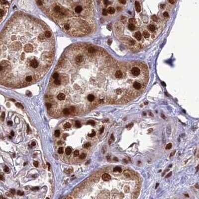 Immunohistochemistry-Paraffin: DDX1 Antibody [NBP1-85294]
