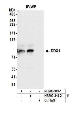 Immunoprecipitation: DDX1 Antibody [NB200-349]