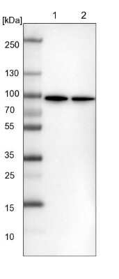 Western Blot: DDX1 Antibody [NBP1-85293]